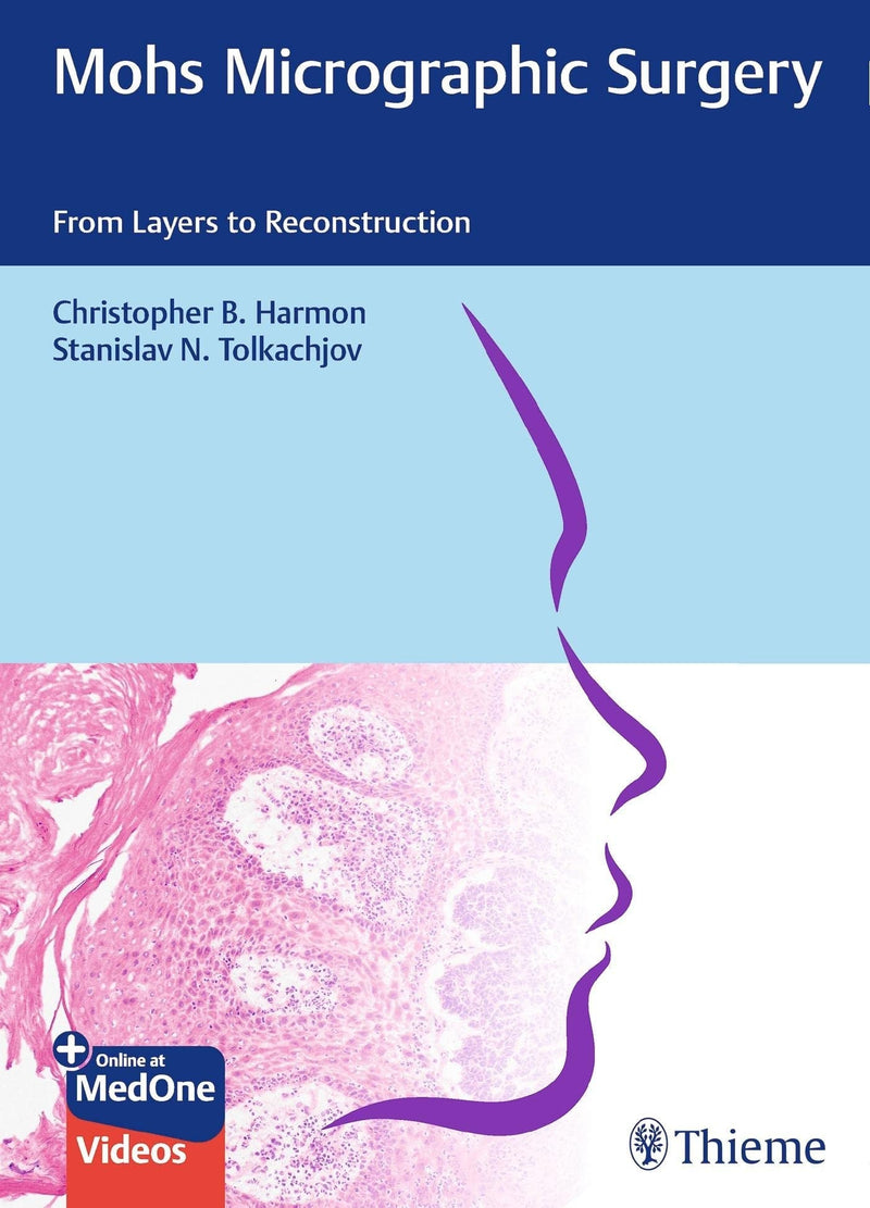 Mohs Micrographic Surgery From Layers to Reconstruction 1st Edition