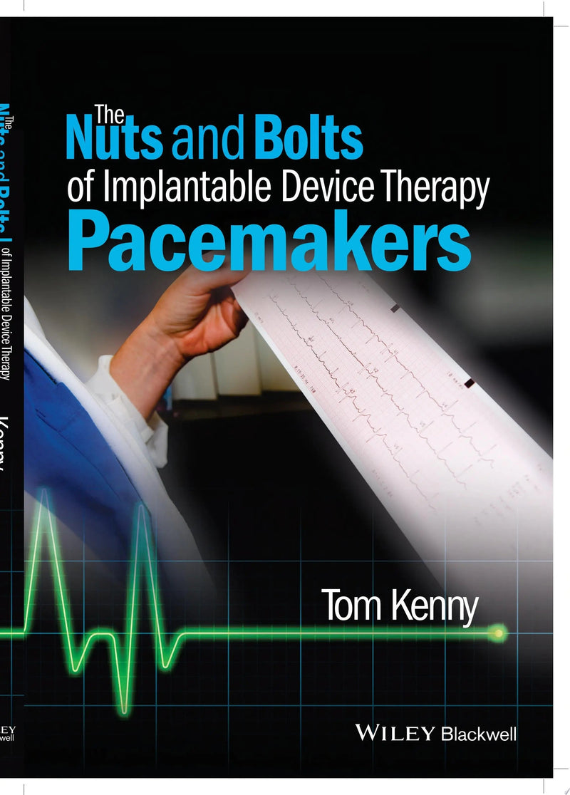 The Nuts and Bolts of Implantable Device Therapy Pacemakers by Tom Kenny 1st Edition ISBN 9781118670675