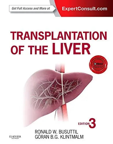 Transplantation of the Liver by Ronald W. Busuttil ISBN: 978-1455702688