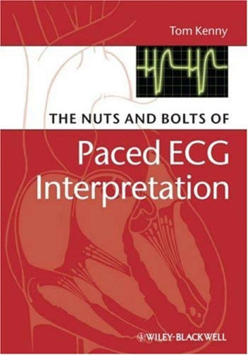 The Nuts and bolts of Paced ECG Interpretation by Tom Kenny 1st Edition ISBN 9781405184045