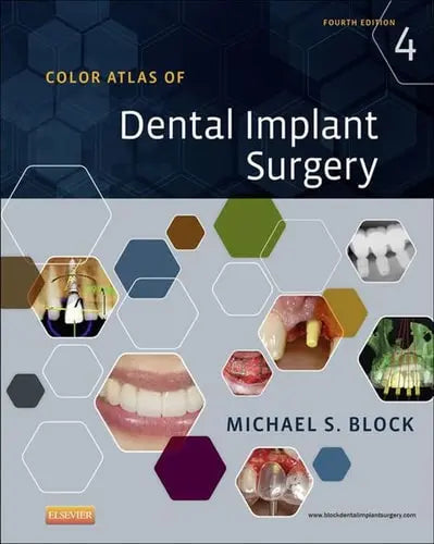 Color Atlas of Dental Implant Surgery by Michael S. Block ISBN: 978-1455759682