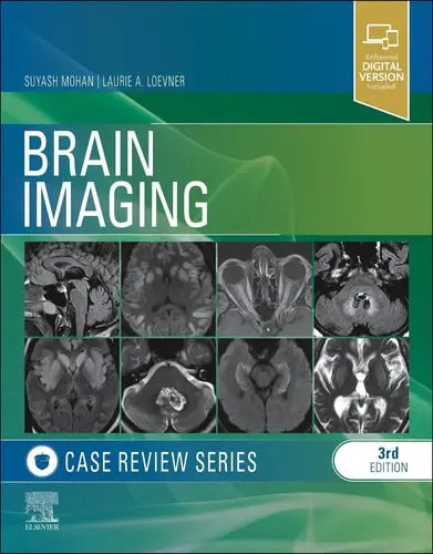 Brain Imaging Case Review Series by Suyash Mohan ISBN: 978-1455774852