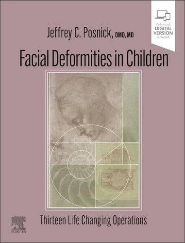 Facial Deformities in Children Thirteen Life Changing Operations by Jeffrey C. Posnick