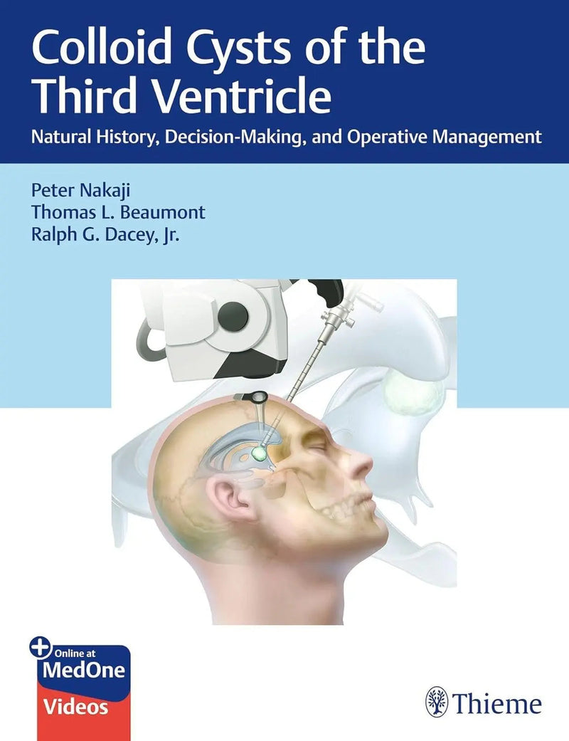 Colloid Cysts of the Third Ventricle Natural History, Decision-Making, and Operative Management by Peter Nakaji ISBN 9781684201563