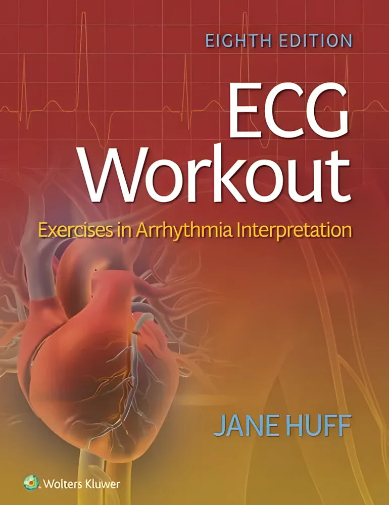 ECG Workout Exercises in Arrhythmia Interpretation by Jane Huff